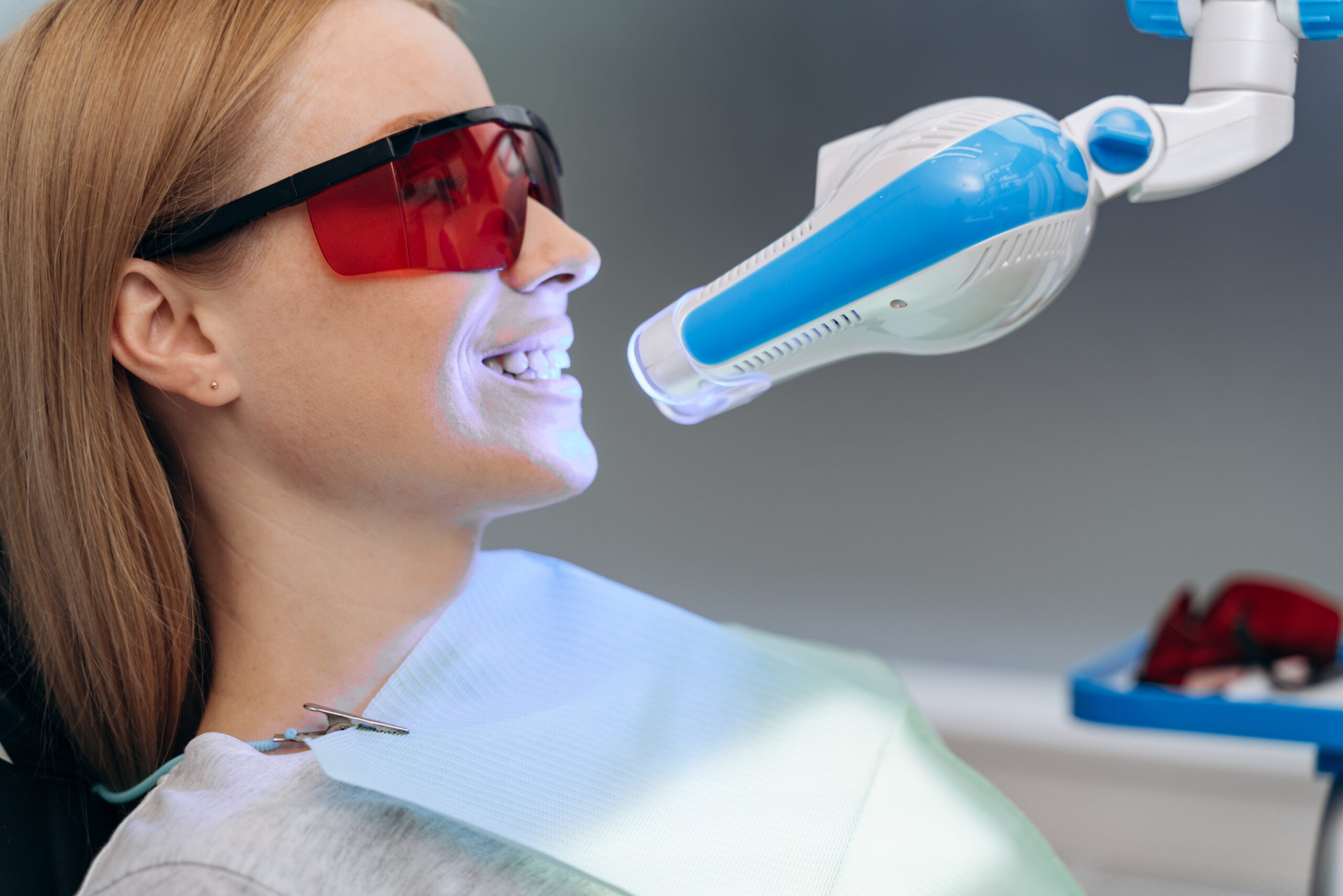 Teeth Whitening milton