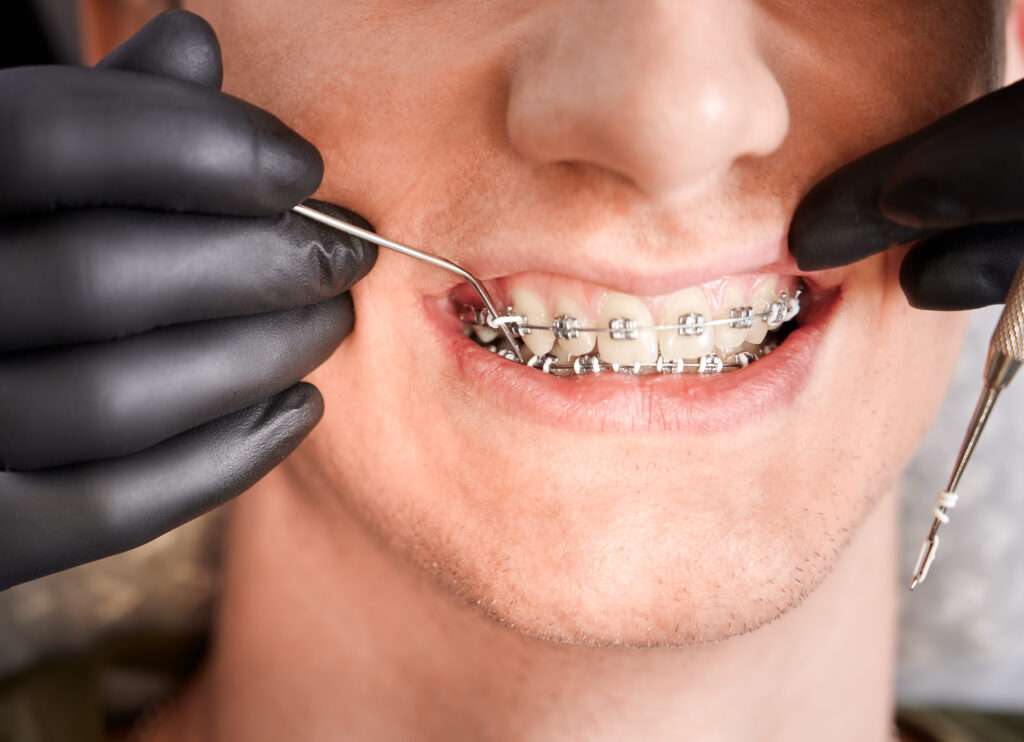 Orthodontist in Milton Ontario